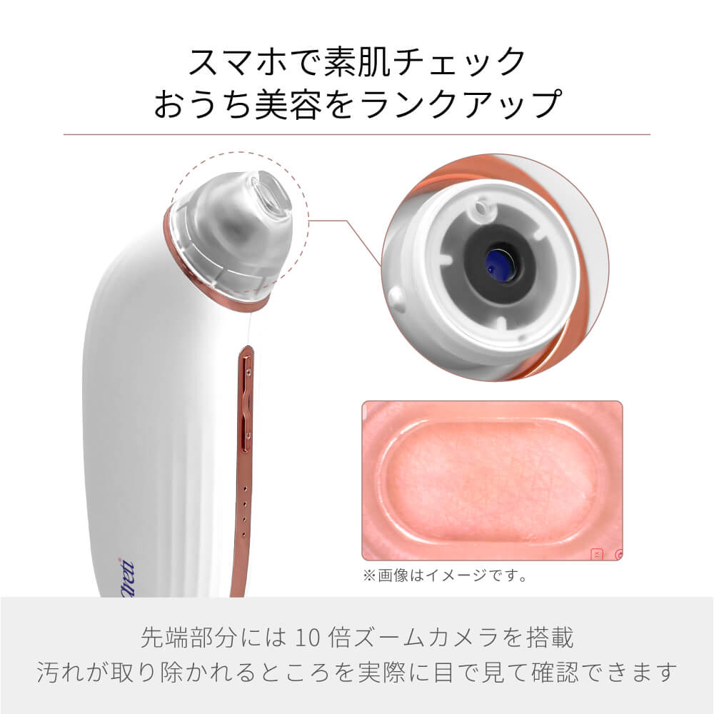 【予約で割引も】Porescope 毛穴吸引器 毛穴汚れ スマホ連動 b2007WH