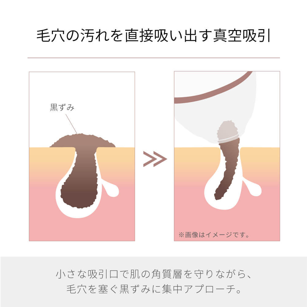 【予約で割引も】Porescope 毛穴吸引器 毛穴汚れ スマホ連動 b2007WH